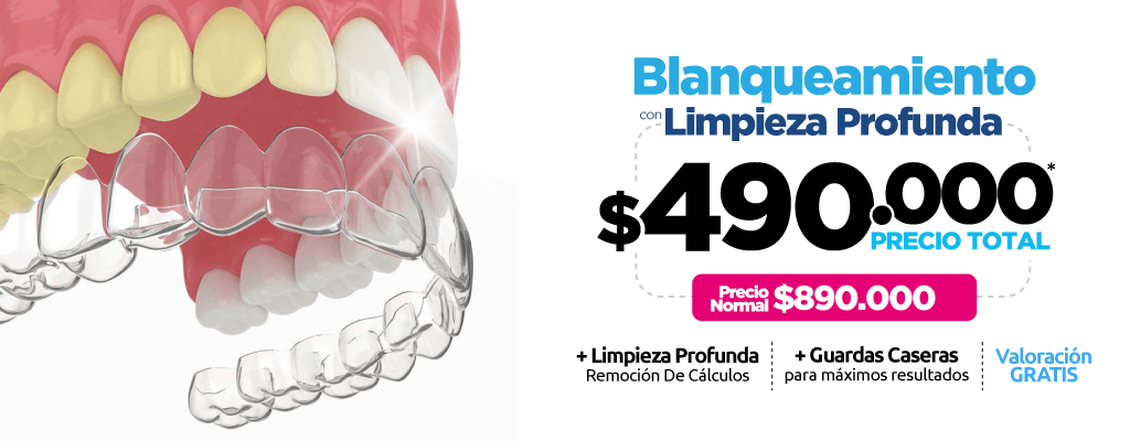 Blanqueamiento Dental + Limpieza Profunda por tan solo $490.000
