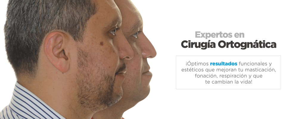 Cirugía Ortognática en Bogotá
