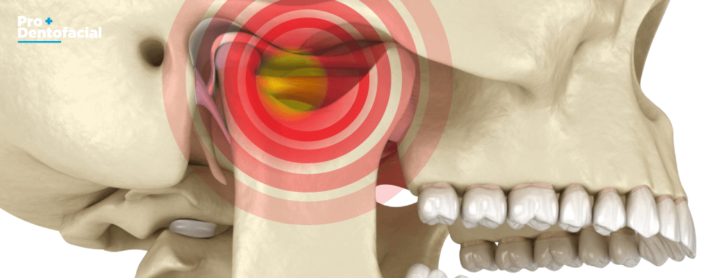 Trastornos de la ATM - Articulación Temporomandibular
